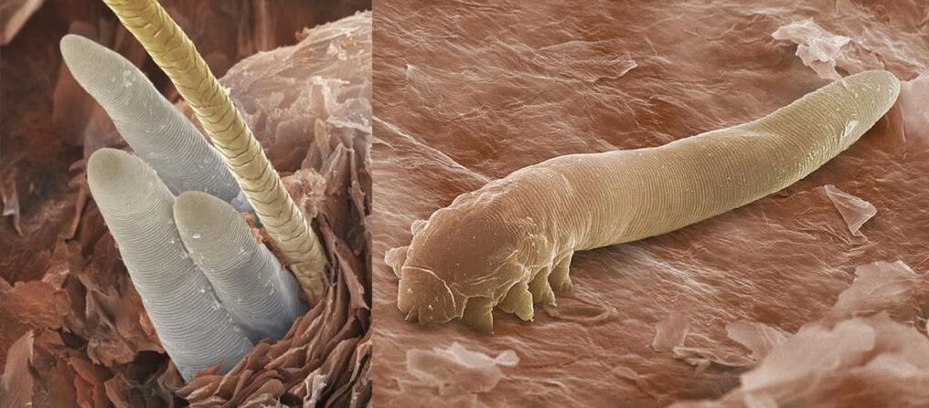 Ektoparasiten