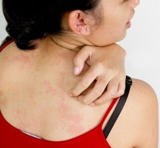 Granulome im Körper sind Symptome für das Vorhandensein von Parasiten