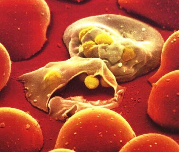der einfachste Malariaparasit Plasmodium