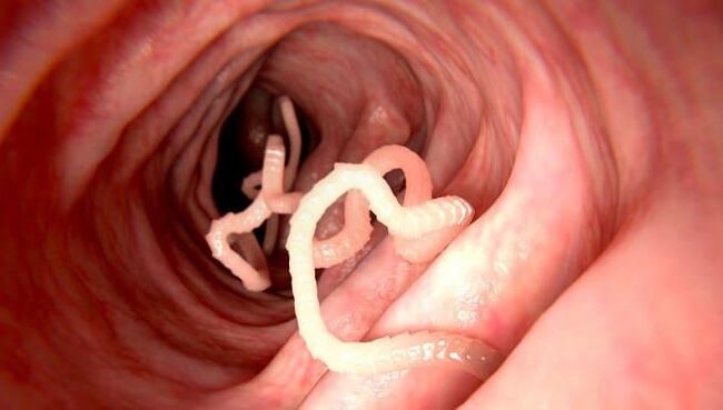 Würmer, die im menschlichen Darm leben. 