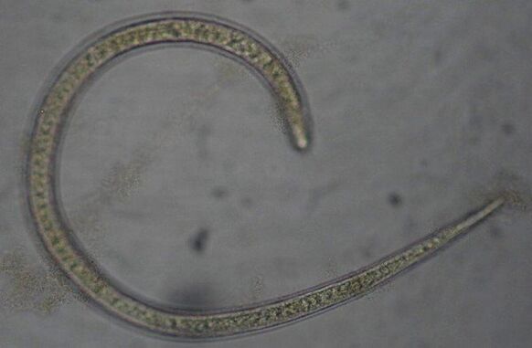 Trichinella ist ein parasitärer Protostom-Spulwurm
