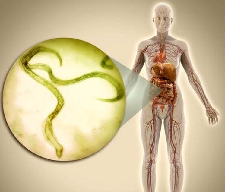 Parasiten im Körper