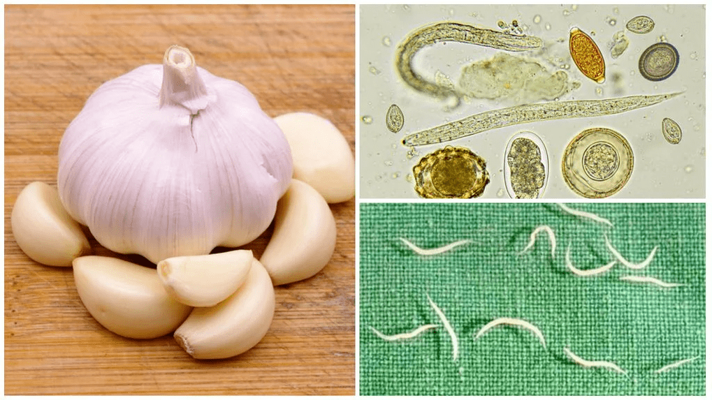 Parasiten im Körperpopulärmethoden